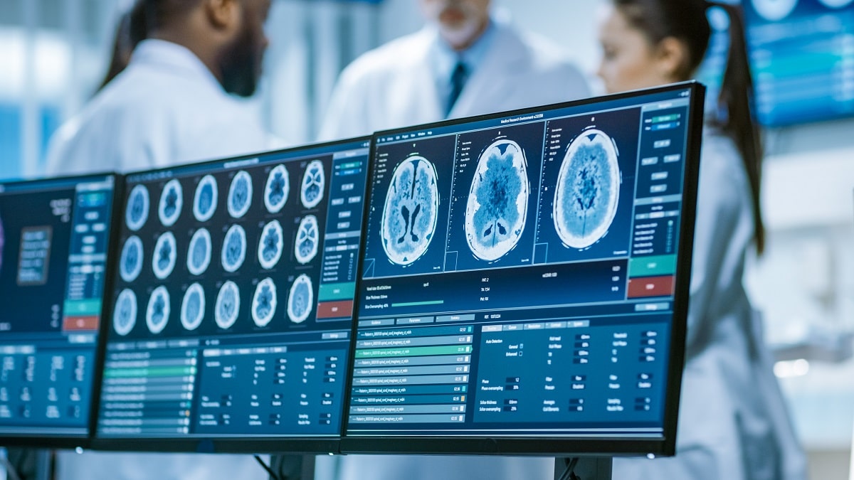 Exploración cerebral TBI en el consultorio del médico en las pantallas de computadora