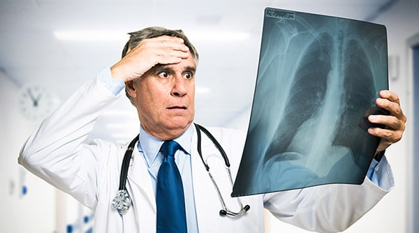 Doctor examining x-ray in disbelief
