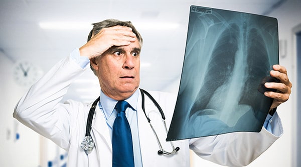 Doctor examining x-ray in disbelief