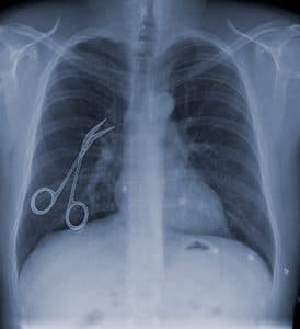 Radiografía con tijeras quirúrgicas dejadas en el paciente después de la cirugía