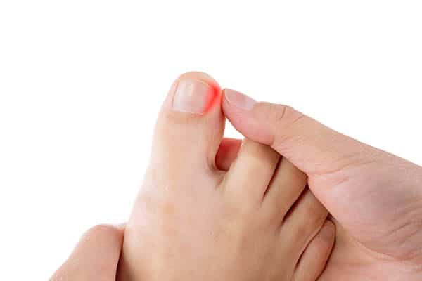 How You Can Avoid an Infection From a Salon Pedicure